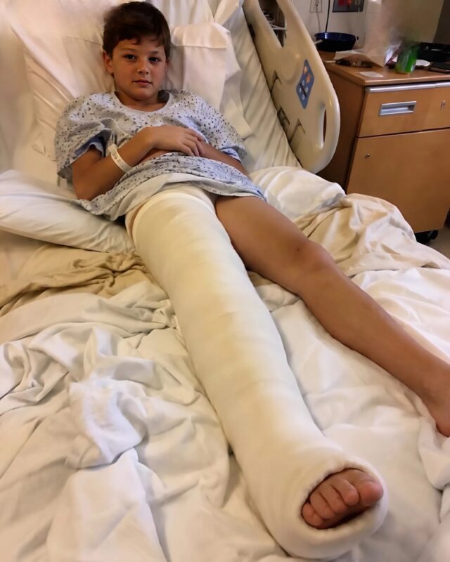 Otišla sam u bolnicu da se brinem o sinu koji je imao slomljenu nogu, ali medicinska sestra mi je krišom gurnula komadić papira u ruku i šapnula: „Laže. Provjerite kameru iz sobe u 3 ujutro.“ 😰😨 - featured image
